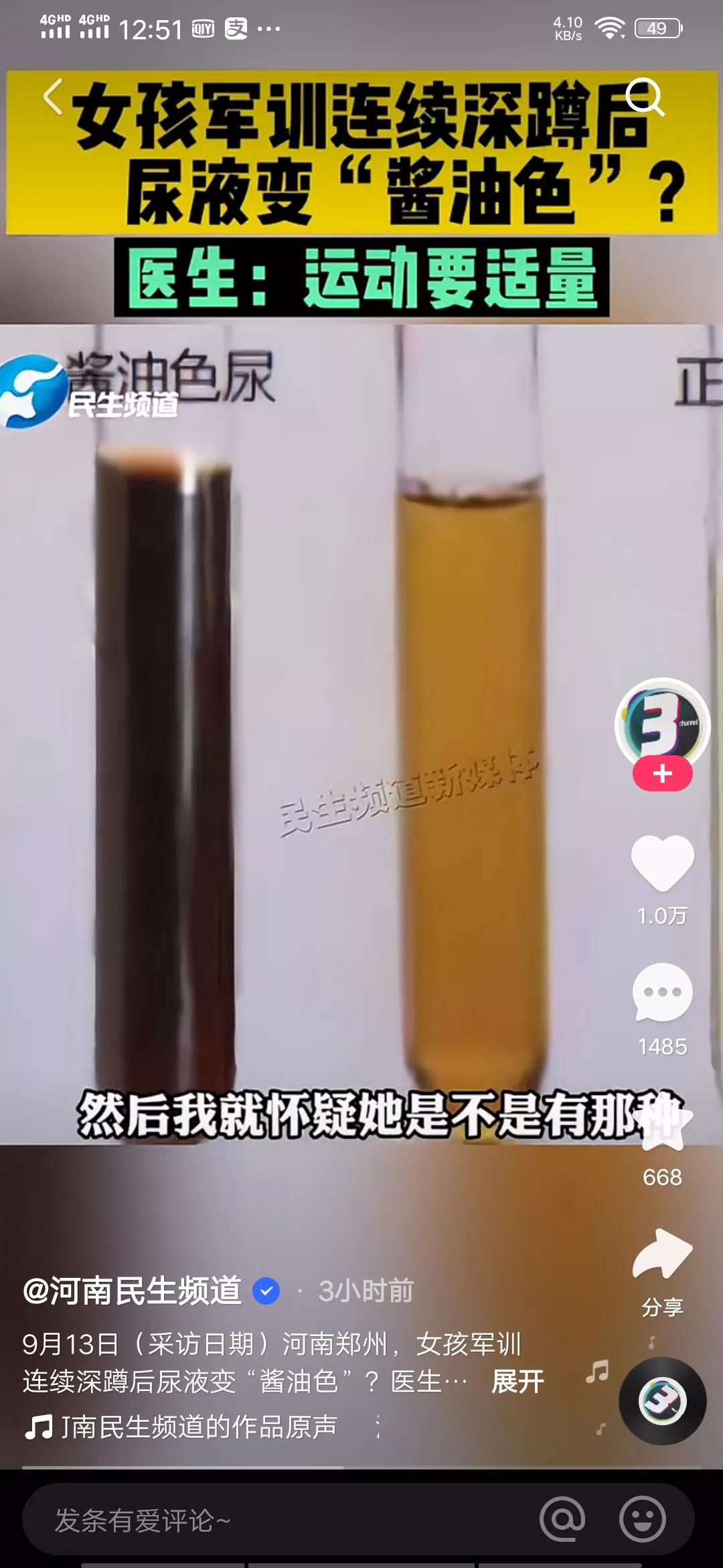 女子尿液变成酱油色,女性尿液突然变酱油色