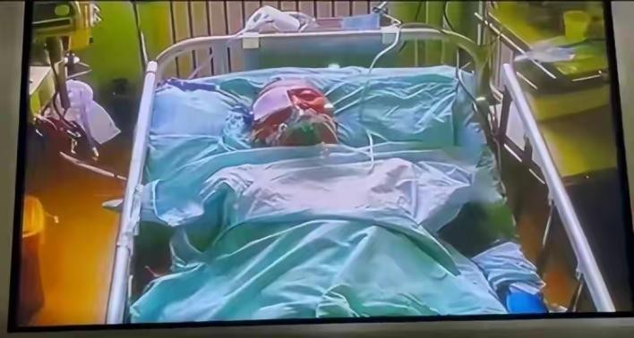 老兵被养老院护工打爆眼球,73岁老人被养老院护工打爆眼球