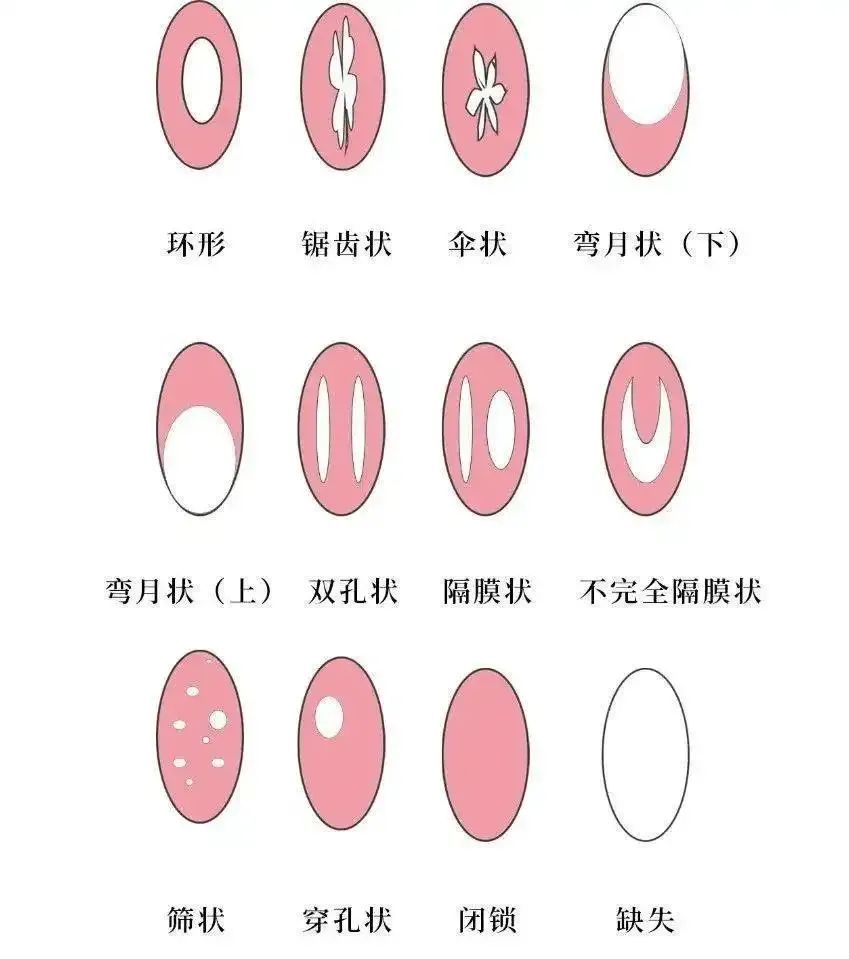 「科普」第一次啪啪啪到底需要注意什么？