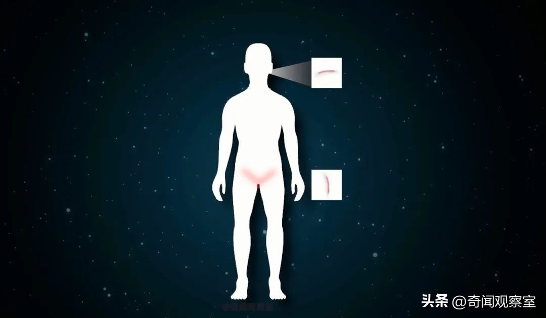 日本三十二年前的密室杀人案,身上没有伤口但是无缘无故出血