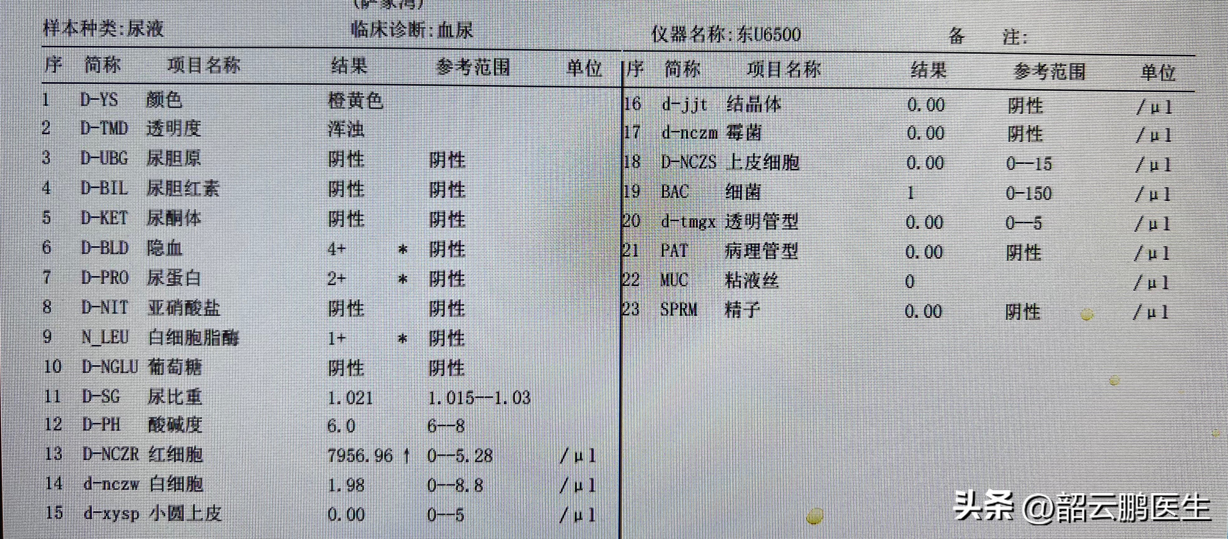 尿常规可以发现哪些异常,尿常规有两个加号代表什么