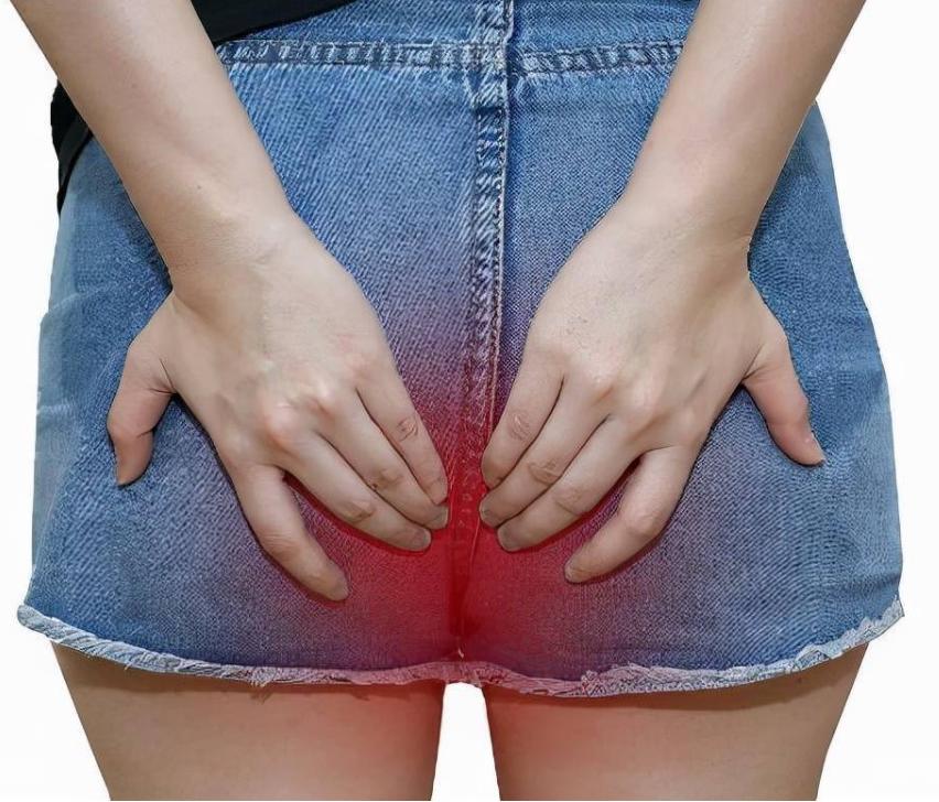 肛门周围潮湿瘙痒到底怎么治疗,肛门周围潮湿瘙痒是怎么治疗