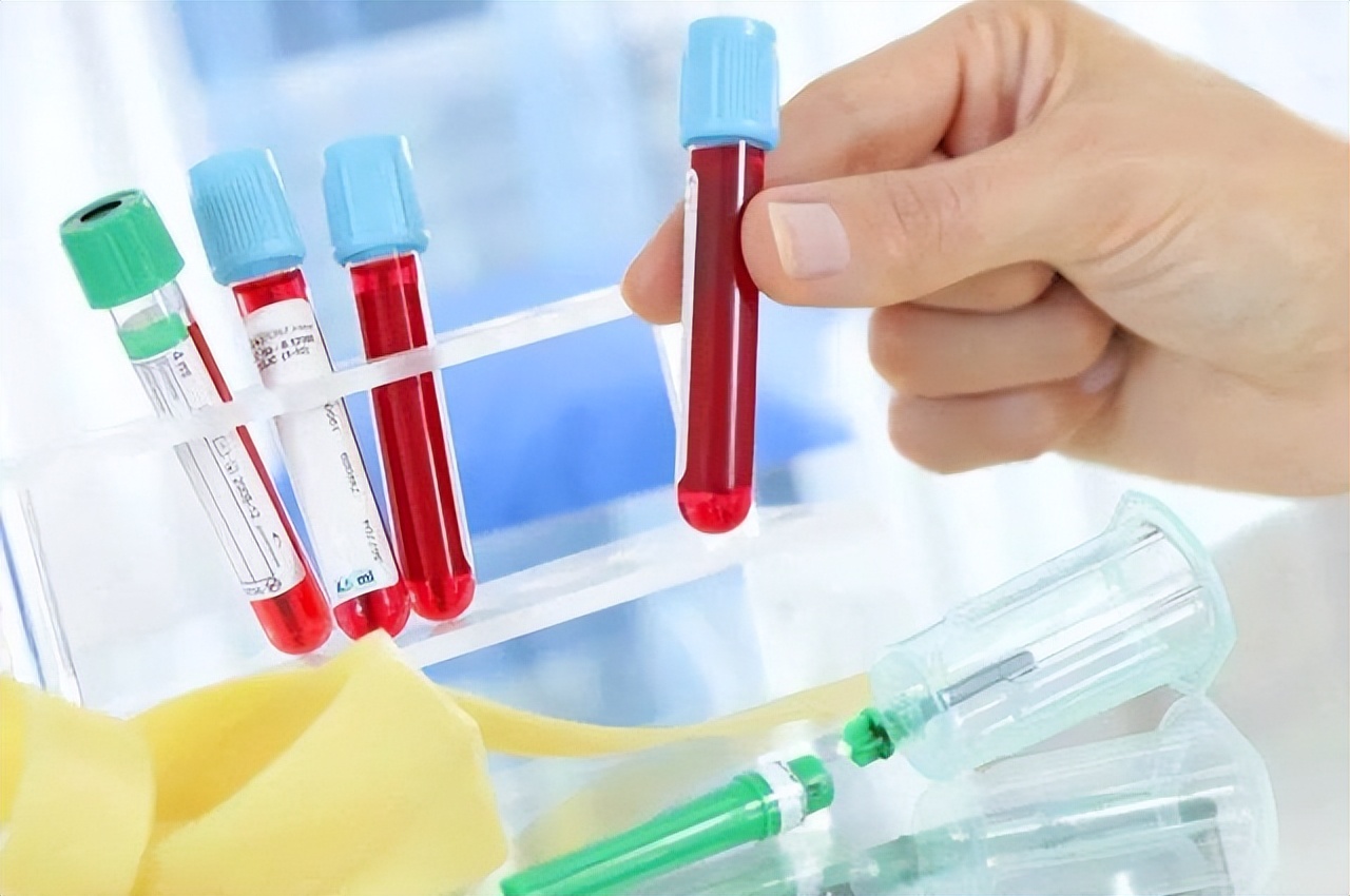 医学检验科检查的项目,检验科全套检查有哪些项目