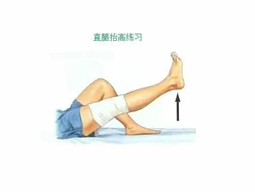 后角半月板撕裂微创手术,半月板撕裂微创手术沈阳