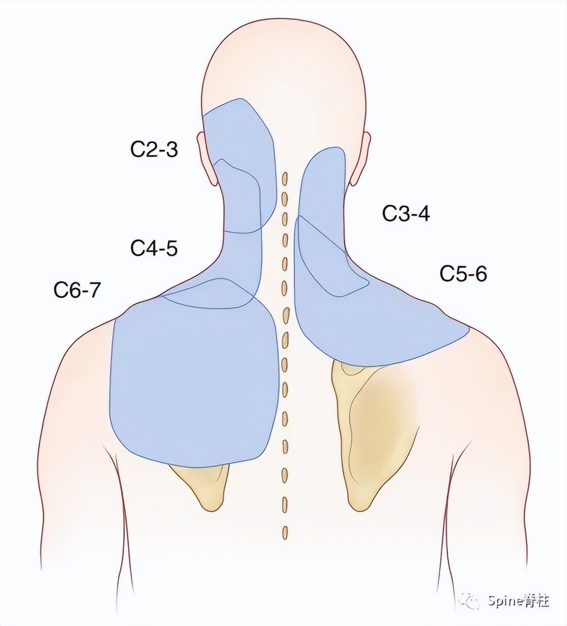 脊柱神经支配疼痛区域,脊柱神经支配的脏腑
