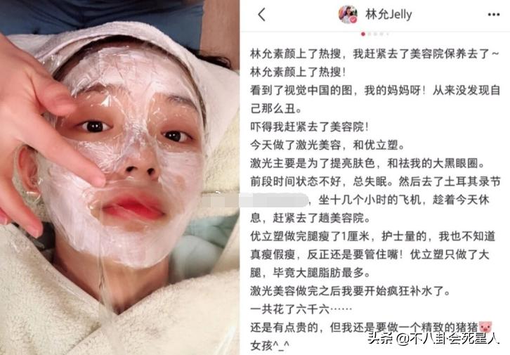 景甜双眼皮调整前后,明星自曝医美