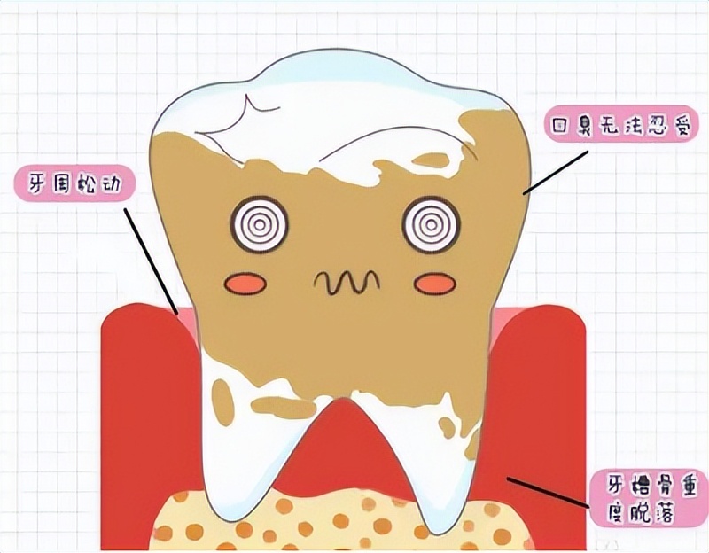 全网热门电动牙刷测评：六大维度深度实测，精准排雷