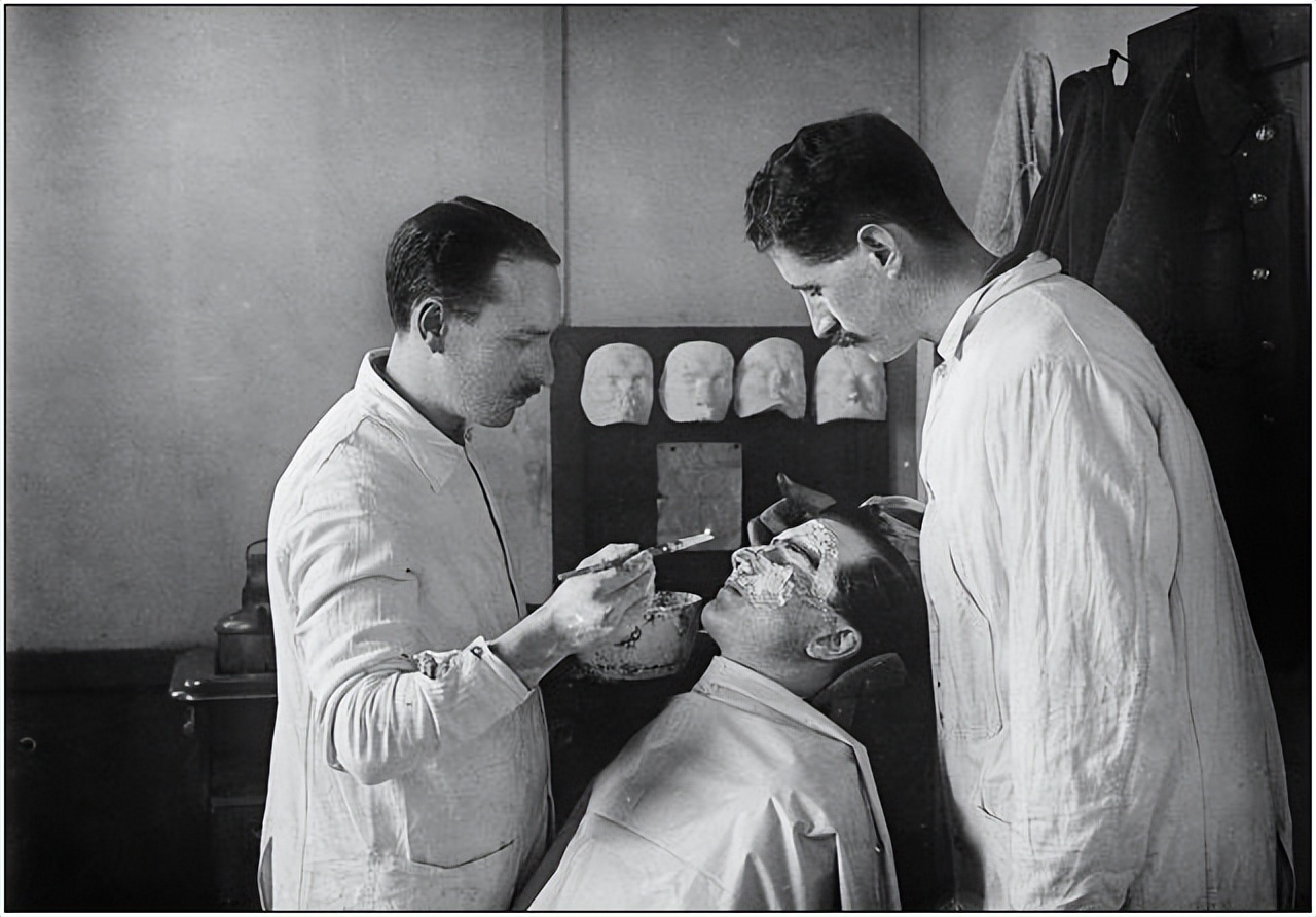 空姐注射玻尿酸打进血管险丧命,一空姐注射玻尿酸险丧命