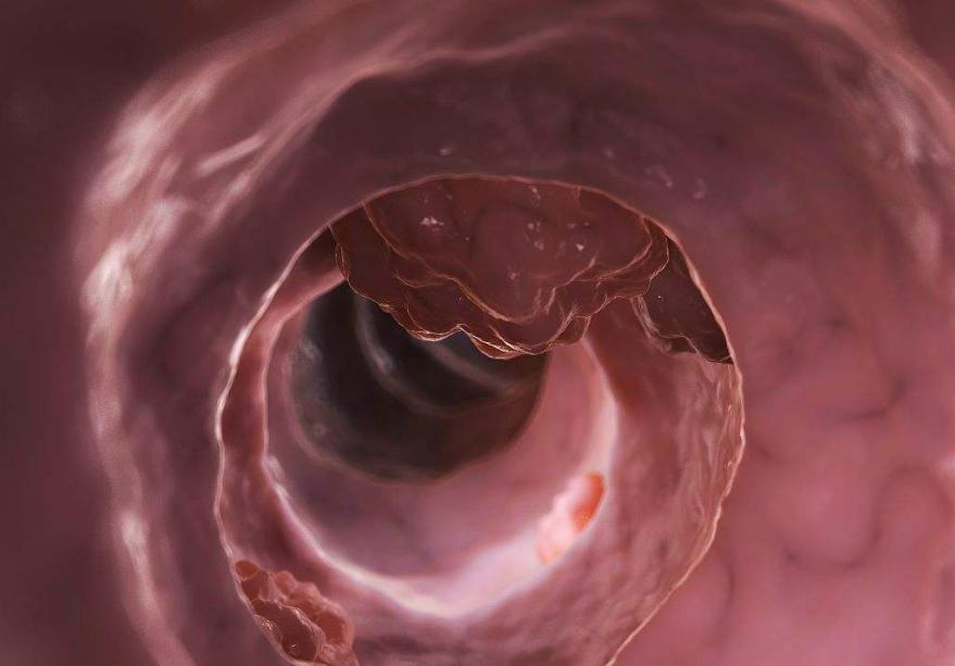 长期服用奥美拉唑要注意以下几点,奥美拉唑是毒药吗