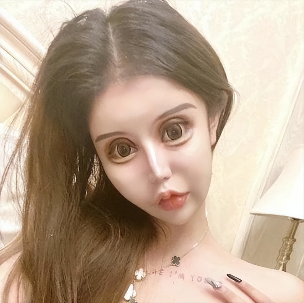 15岁网红自曝整形超100次，后遗症记忆力衰退，换脸停不下来