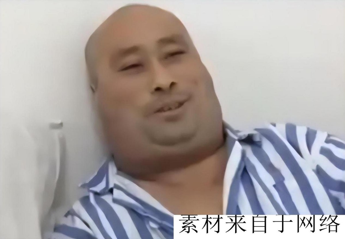 酗酒40年喝成河马脖,辽宁男子喝酒达三万斤