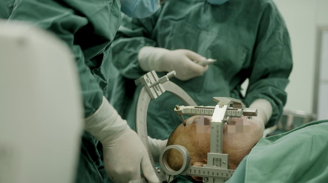 水矿总医院的大体情况,特发性脑震颤的最新疗法