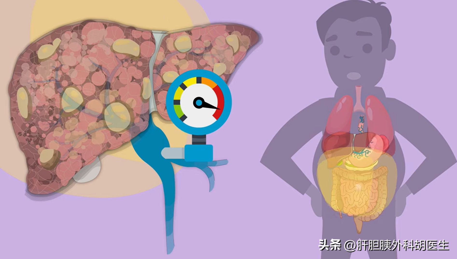 肝硬化腹水按何穴位有特效,肝硬化腹水越来越瘦怎么办