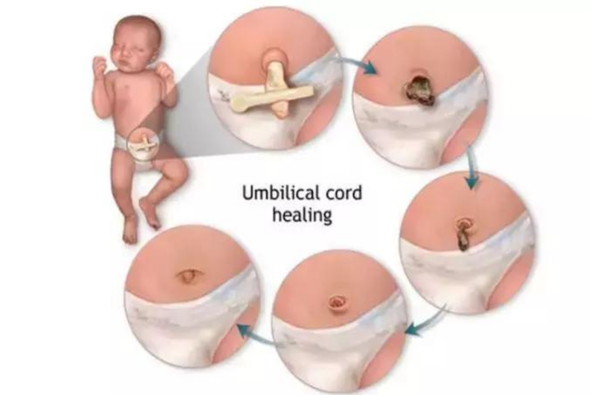 八个月宝宝肚脐眼黑泥怎么清理,宝宝肚脐眼黑黑的泥巴要清洗吗