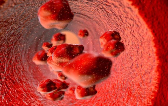 血脂高从脾胃化浊入手,治疗脾胃虚弱血脂高的方子