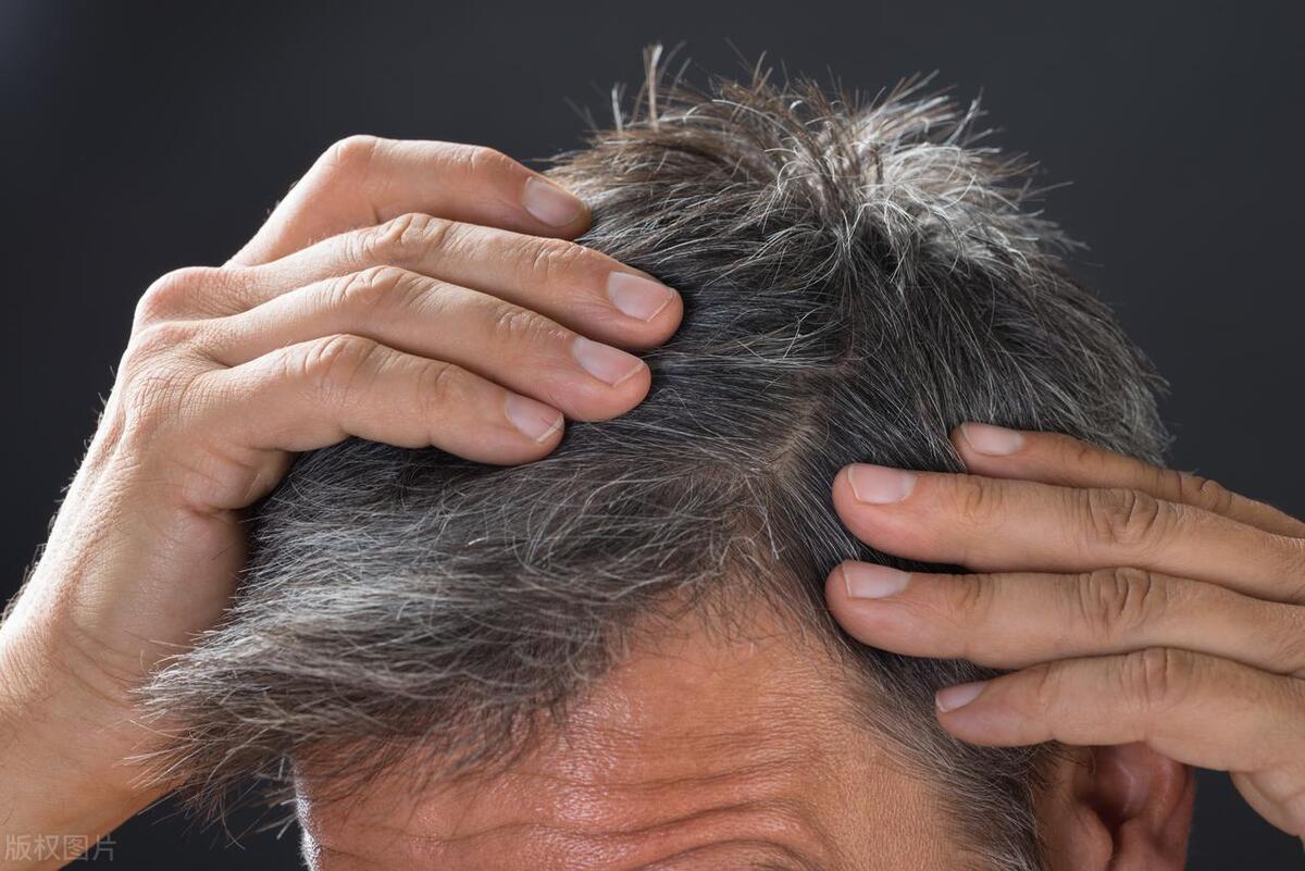 为啥白头发越来越多怎么调理,为什么白头发越来越多吃什么药
