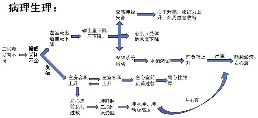 二尖瓣发育不良病例总结