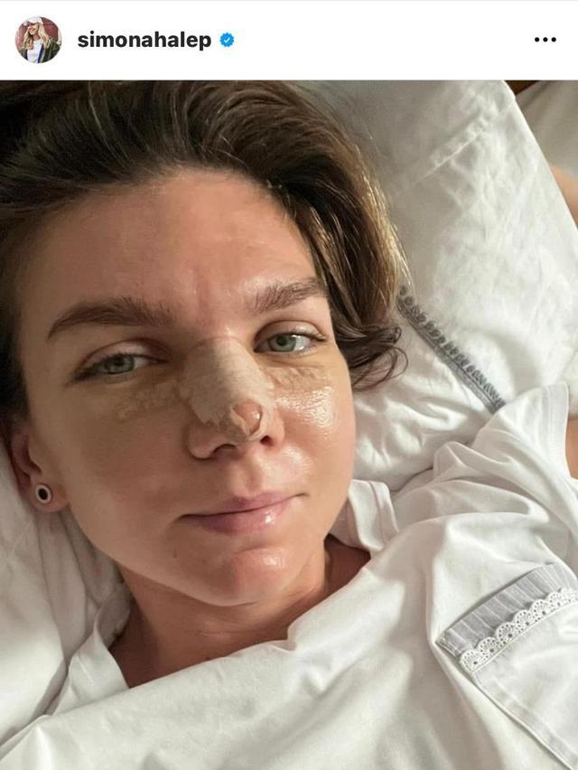 哈勒普兴奋剂事件,哈勒普事件