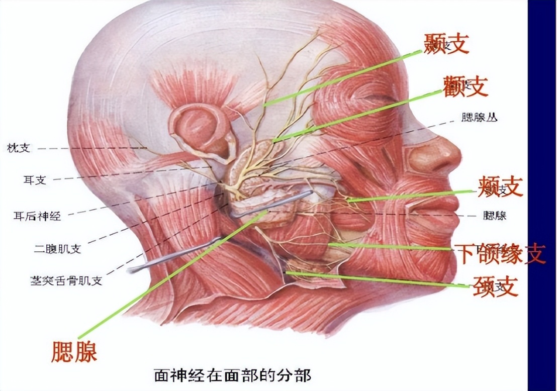 面神经炎不针灸会留后遗症吗,面神经炎后遗症眼睛流泪怎么治