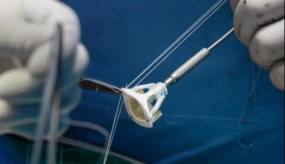 国产肾透析续命一年从患者身上只赚648？