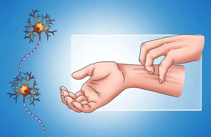 糖友瘙痒治疗方法,糖友皮肤奇痒