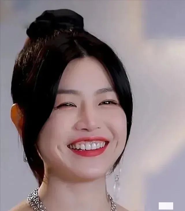 吴宣仪大龅牙,吴宣仪牙不修复吗