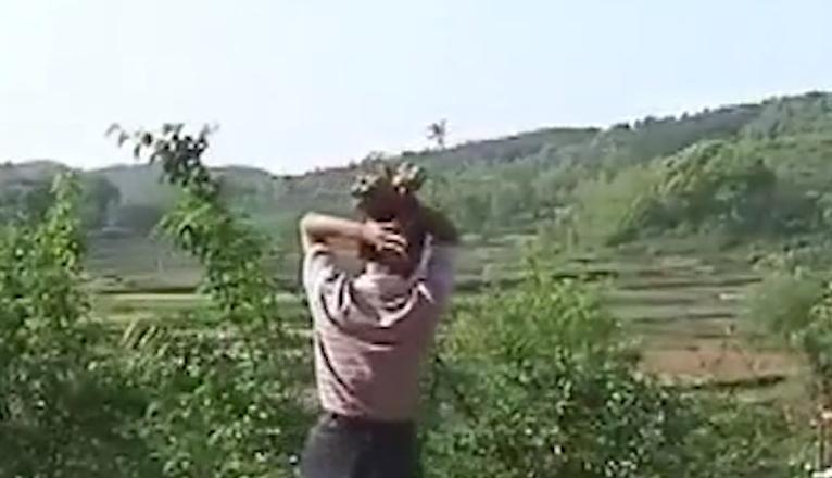 男子得了怪病身上长了树枝,男子患怪病手脚长得像树枝