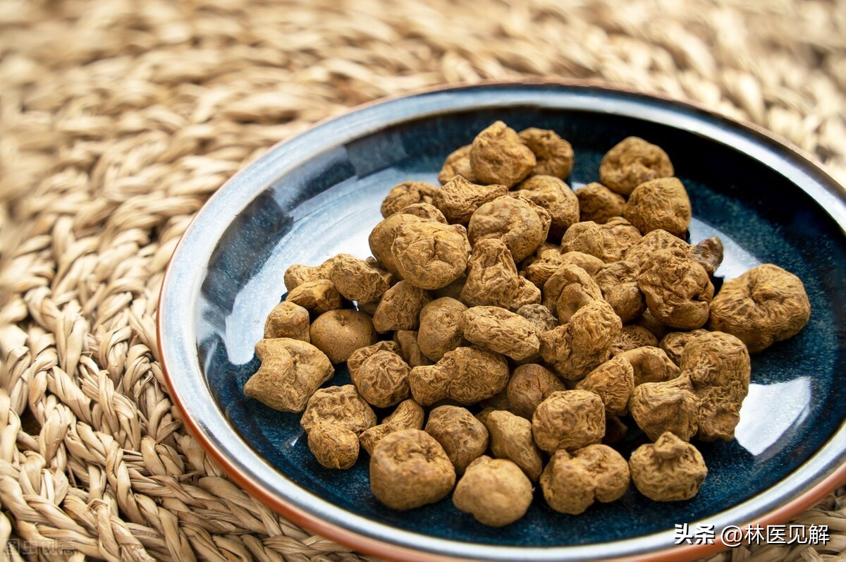 精索静脉曲张小腹坠胀感,湿热下注气滞血瘀精索静脉曲张