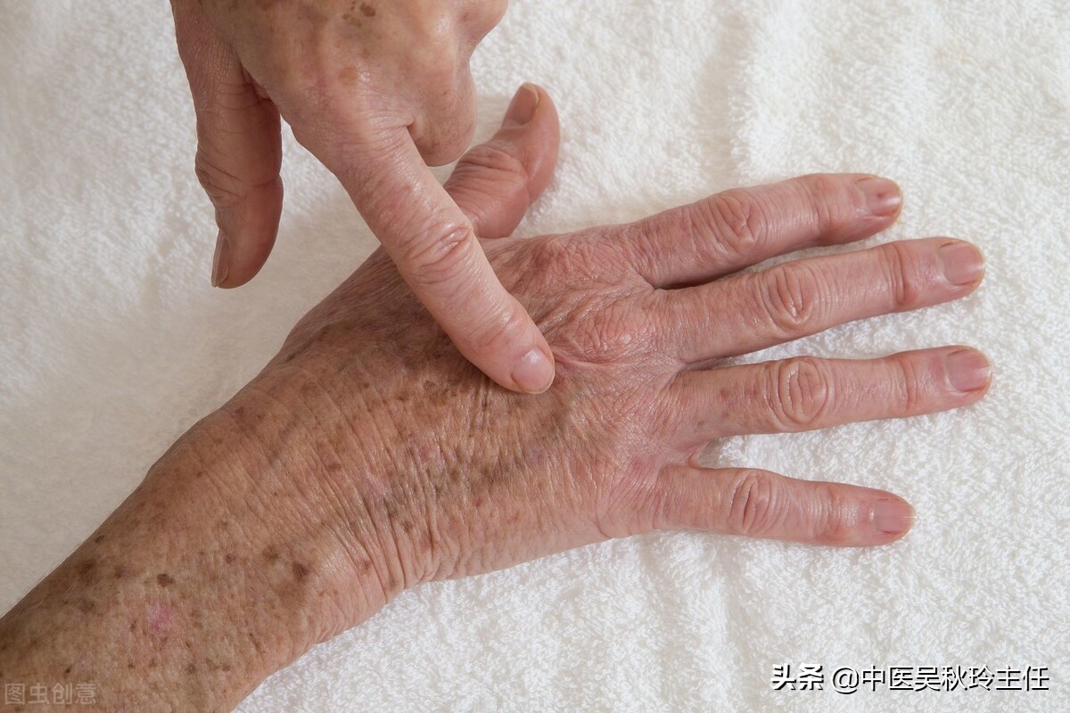 老年斑越来越多是啥原因怎么治,老年斑怎么治疗越省钱越好