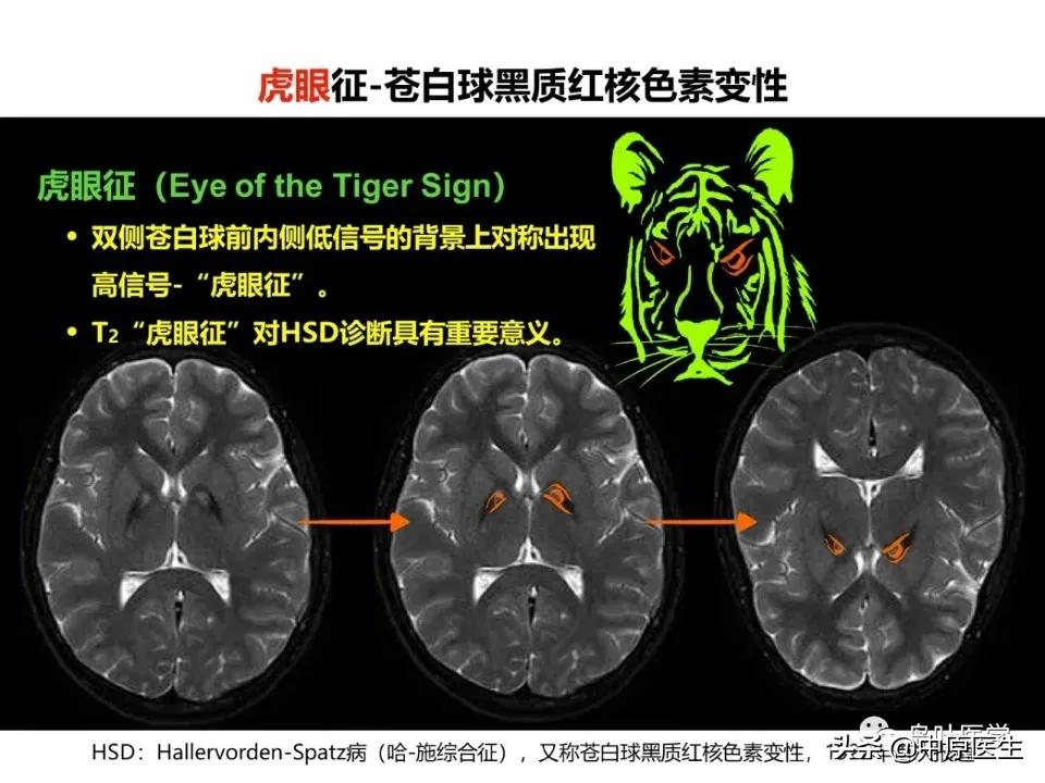 老虎的体质有多强,老虎与人类关系好吗