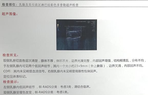 女性胸部结节怎么医,女性乳腺结节怎么治疗效果好呢