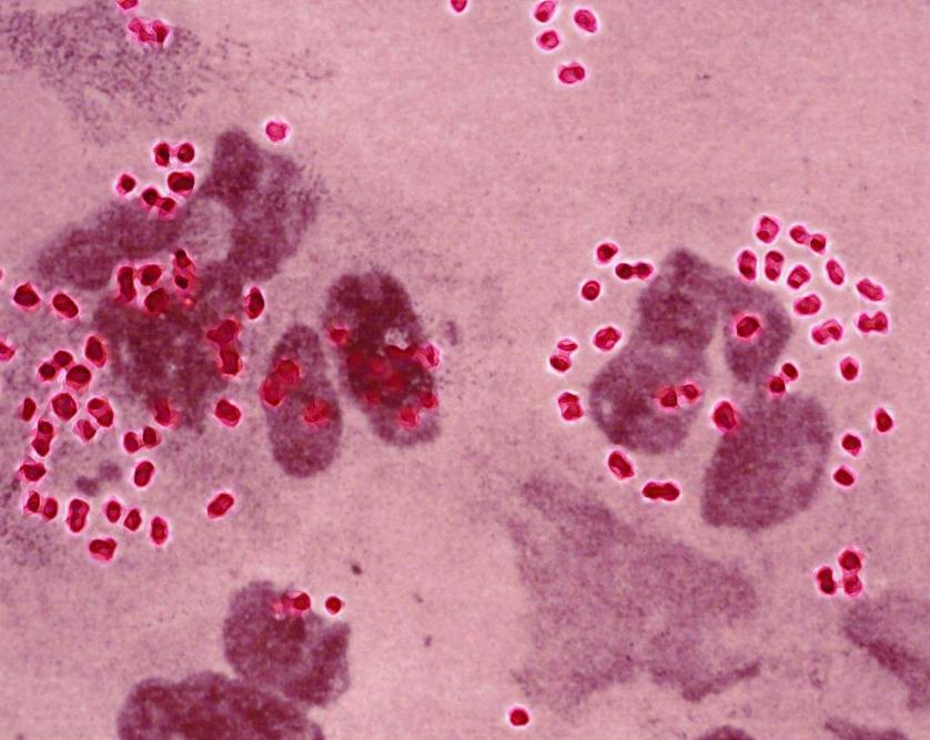 生理上怎么看男人有没有出轨,怎样从生理上看出男人有没有出轨