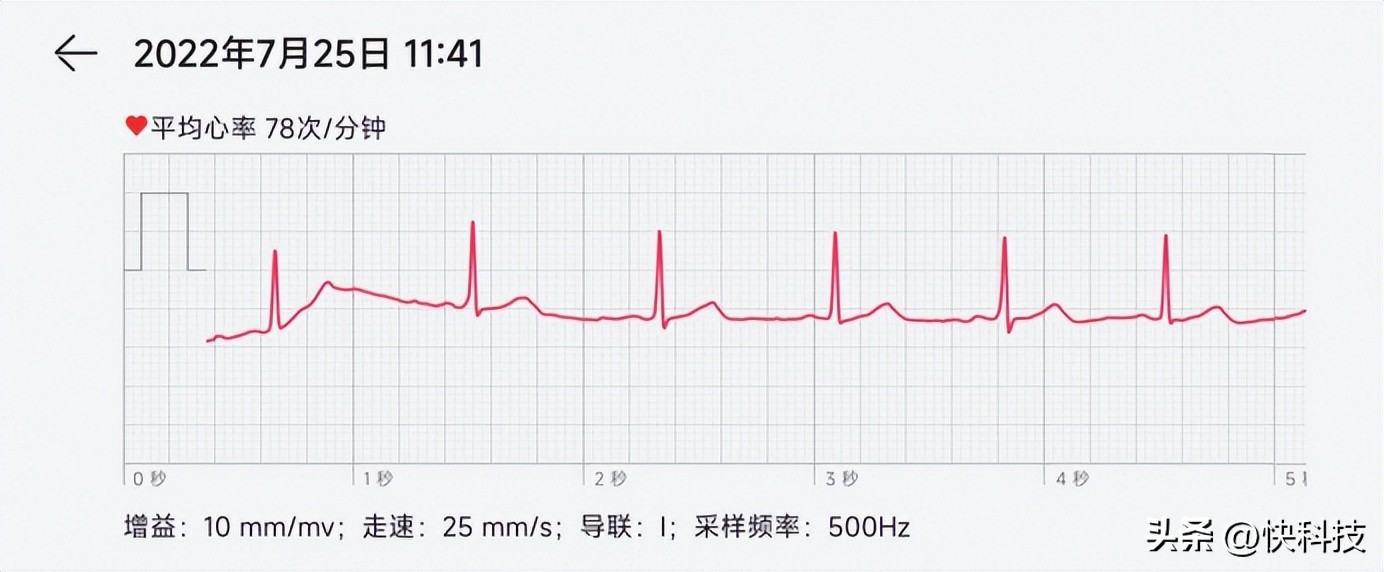 华为watch3pronew有必要开esim,华为watch3proecg测评