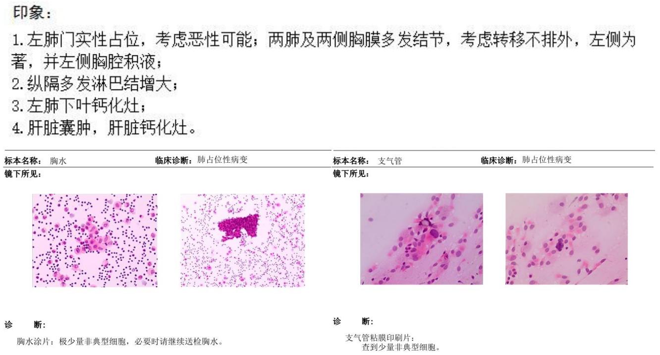 杨弘中山大学肿瘤,杨弘医生怎么样