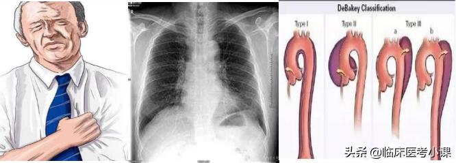 胸痛者常见检查项目,心跳疼痛胸痛是什么症状