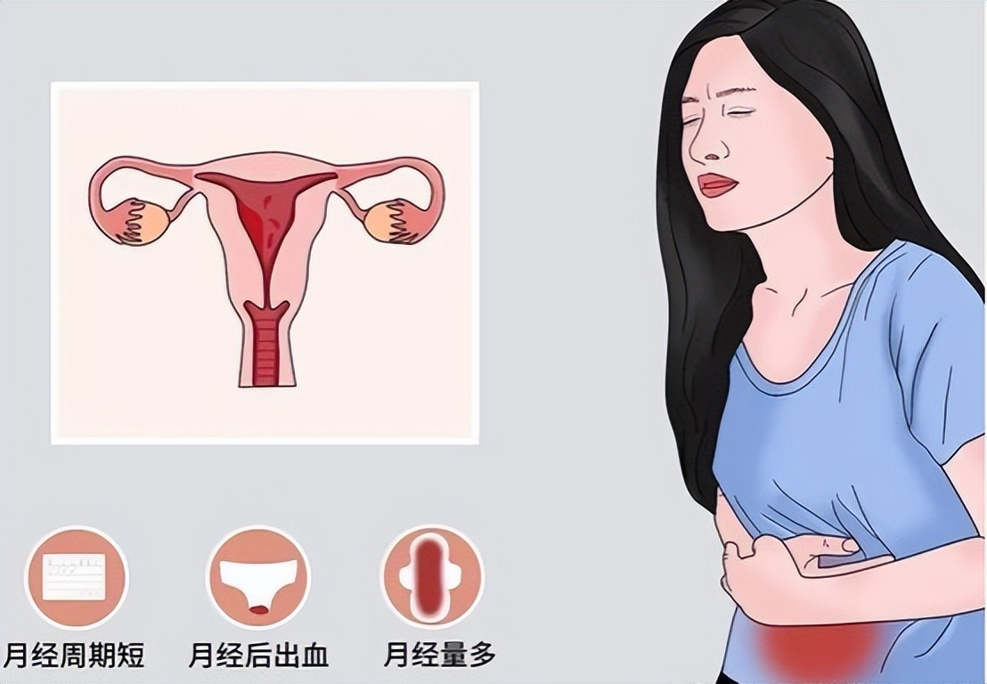 子宫性不孕症诊断与治疗,子宫发育不良性不孕确诊检查