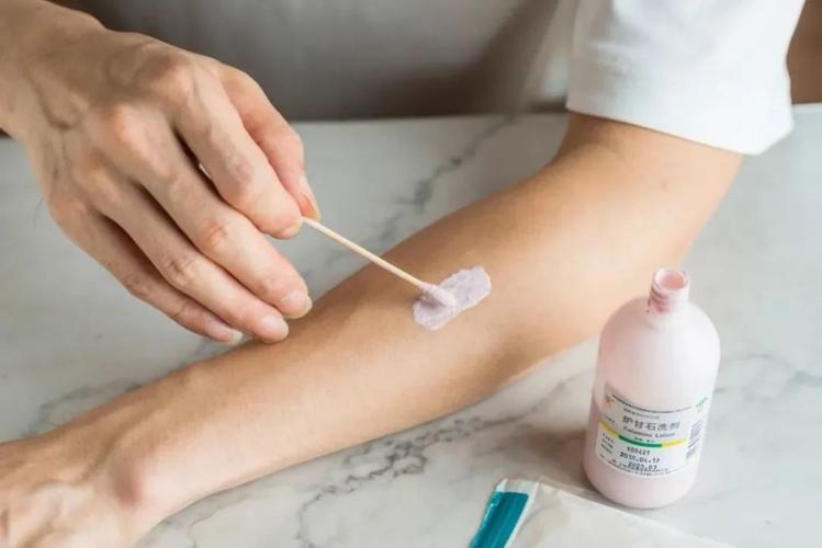 炉甘石洗剂大概要多少钱,炉甘石洗剂一般多少块钱