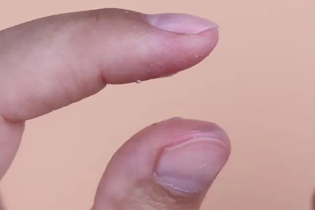 手上粘着502胶怎么办,手上沾了502胶水可以用碘伏去掉吗