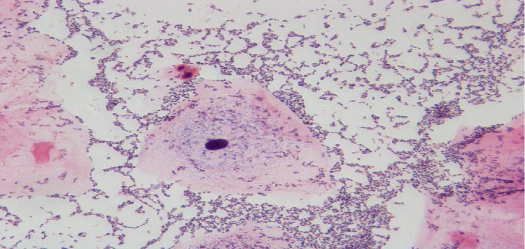 派特灵生物,派特灵生物讲解