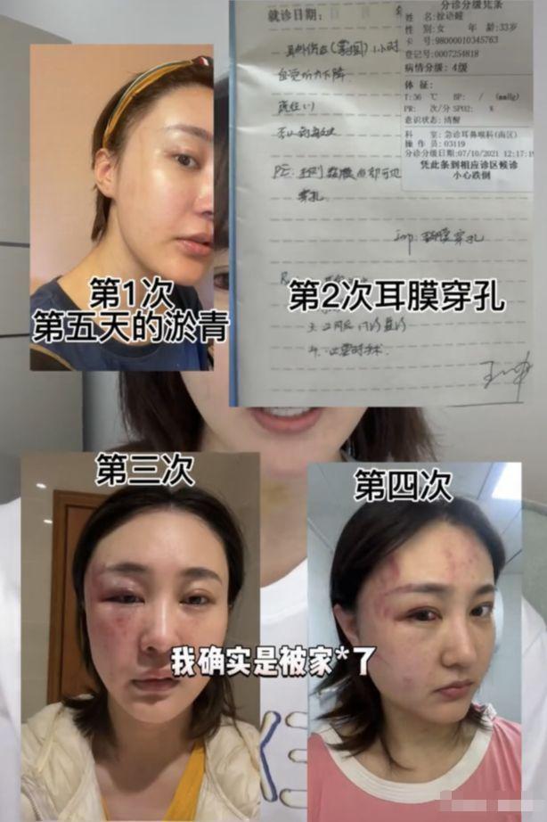 女网红被家暴男朋友是谁,400百万粉丝女网红家暴