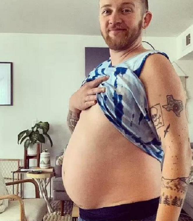 27岁美国男子意外生下一个小孩,世界首例男子成功怀孕