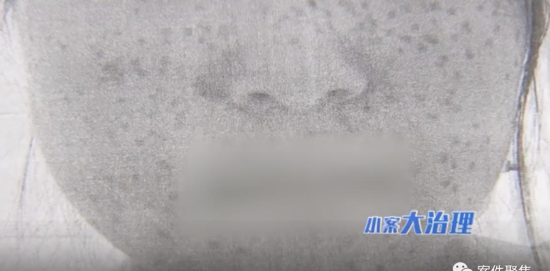 美发店祛斑花费近10万，结果惨变“麻子脸”？