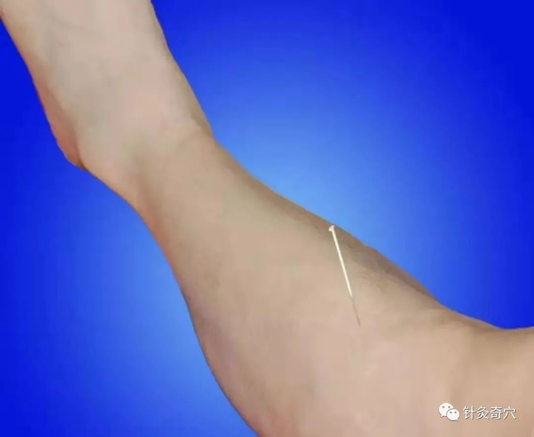 史上最全中医针灸视频教程全集,针灸治疗真实图片大全