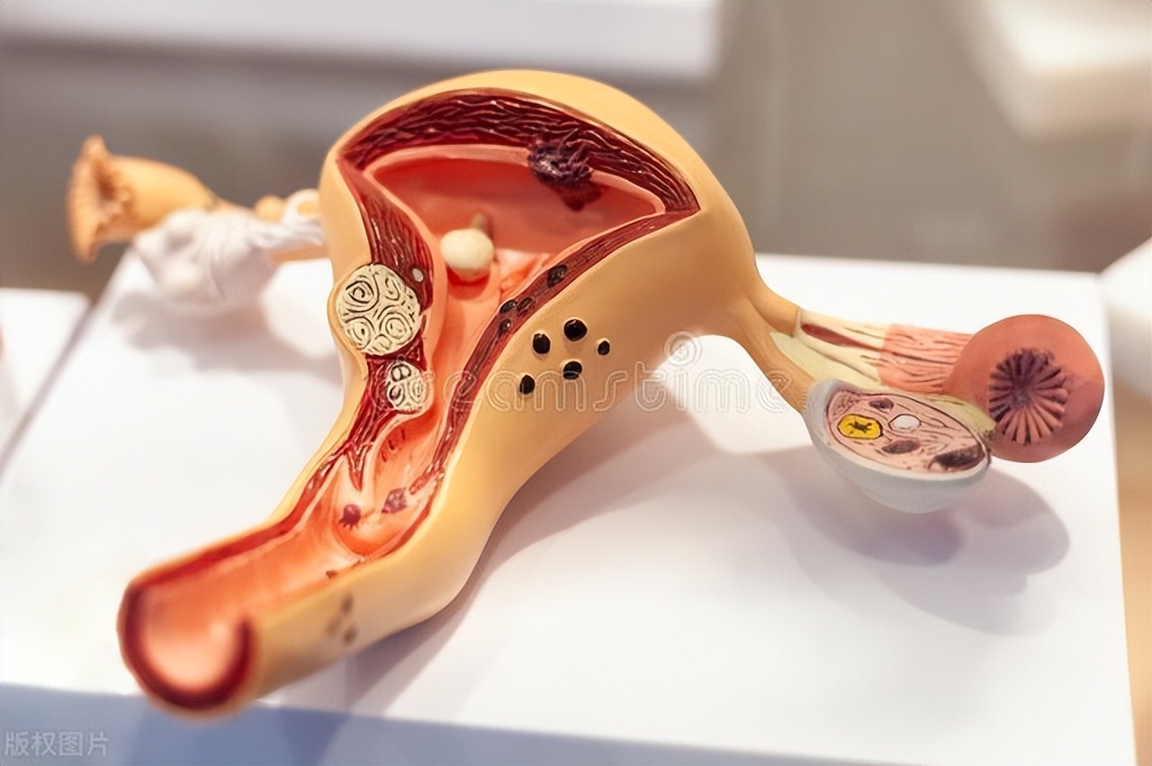 体检发现卵巢囊肿后面复查没有了,卵巢囊肿可以通过教育局体检吗