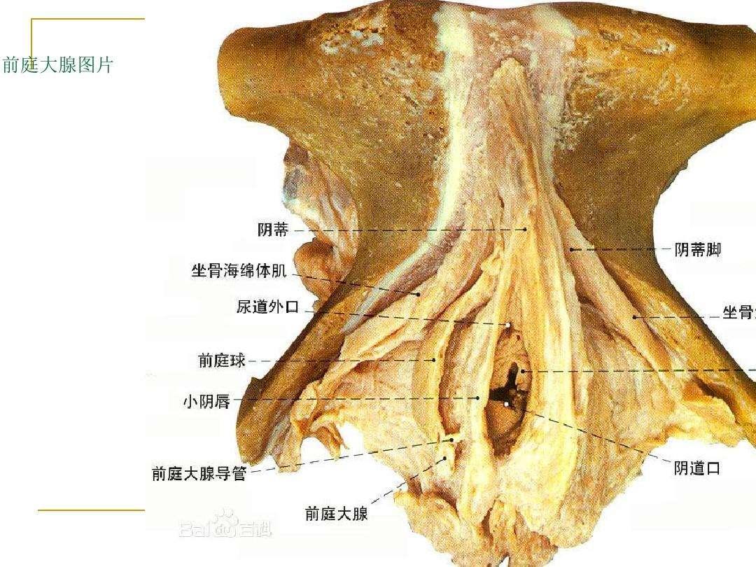 男性尿道挤压有白色物是淋病吗,男性生殖器透明液体是淋病吗