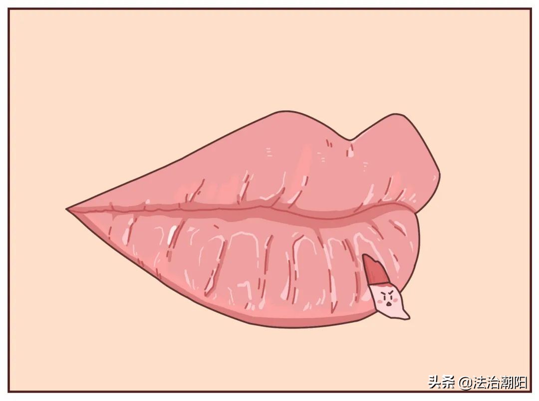 手指长倒刺缺乏哪种维生素,宝宝手指倒刺是缺什么维生素