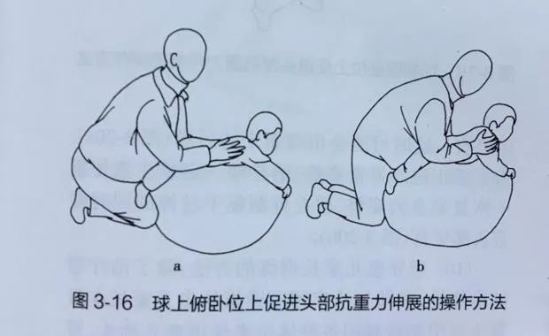 山西太原市儿童康复训练,太原儿童医院康复治疗