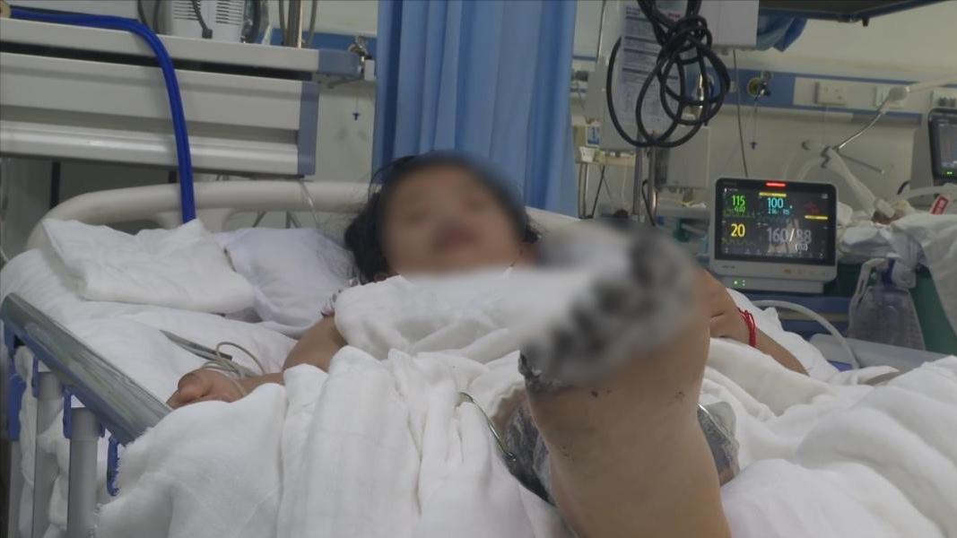 女孩玩苹果手机遭电击截肢,17岁女孩边充电边玩iphone遭电击