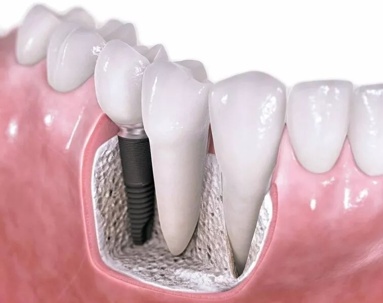 拔牙麻药对人体伤害有多大,牙齿整形需要拔牙伤害身体吗