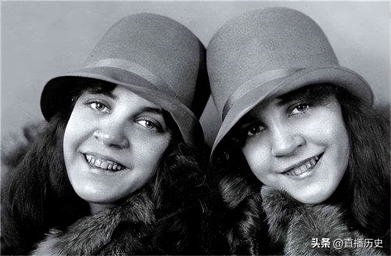 臀部连体姐妹：各有一名丈夫，姐姐死后，妹妹与遗体共存2天去世